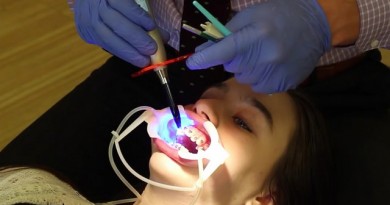 how-much-does-teeth-whitening-cost