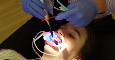 how-much-does-teeth-whitening-cost